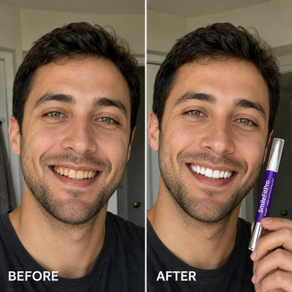 SmileFitPro PAP+ Purple Teeth Whitening Pen